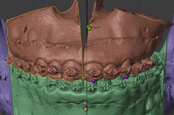 14.2.-Cirurgia-bucomaxilofacial.-Foto-Alberto-Ruy-IgesDF3.jpeg